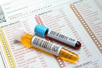 analyse urine