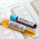 analyse urine